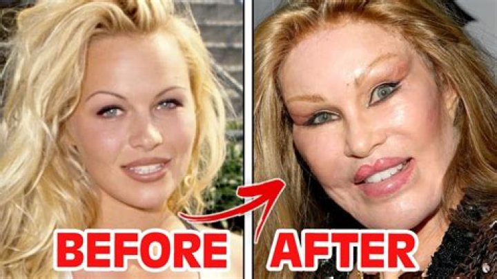 Did Jersey Shore Cast Get Plastic Surgery? – Celebrity