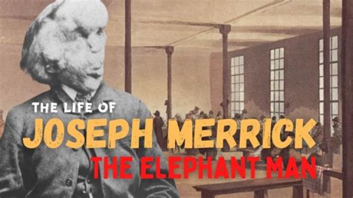 Joseph Carey Merrick Biography - Facts, Childhood, Life