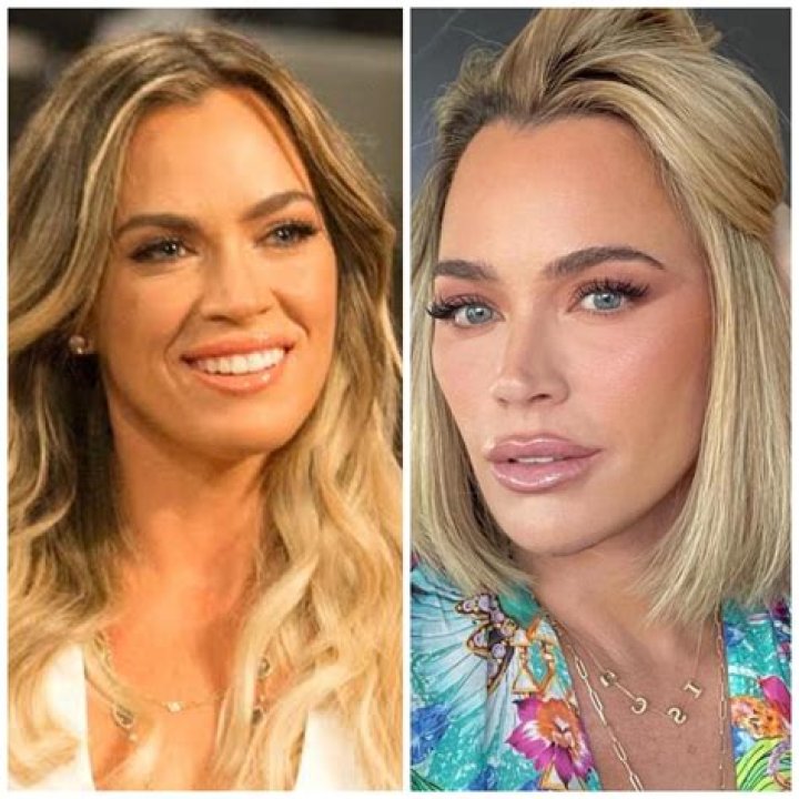 Sheryl Crow Plastic Surgery: Diving Into the Matter to Reveal the Cause of Her Recent Glow-Up!