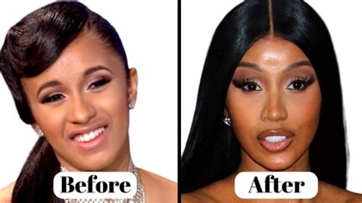 What surgery did Rubi Rose have? Did Rubi Rose have plastic surgery?